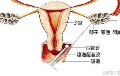 南宁当地有卵子存储医院医院吗？最全2026南宁试管助孕医院排行榜
