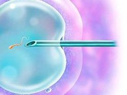 三代试管为什么要做羊水穿刺？