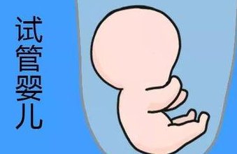 美国第三代试管婴儿费用全攻略，如何合理规划预算